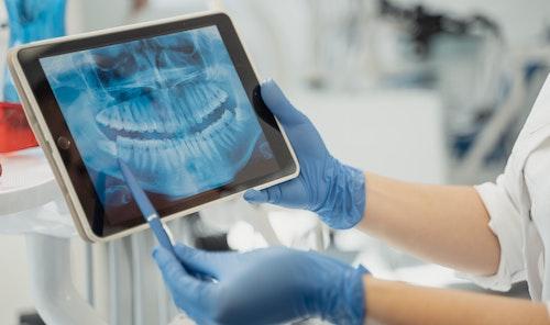 Dentist with panoramic Xray for Dental Implants in Harrisonburg, VA