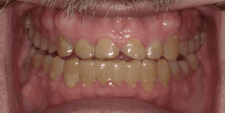 Cosmetic-Dentistry-Before-Image